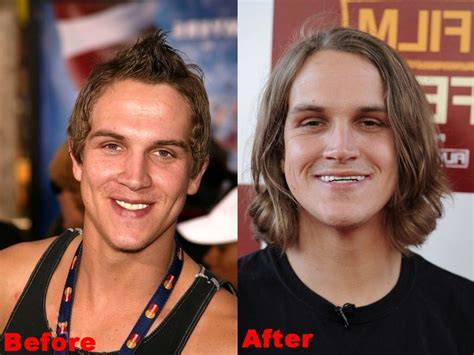 jason mewes teeth problems.